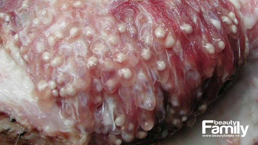 Cách nhận biết thịt chứa sán lợn và bí quyết chọn thịt sạch giữa “tâm bão” dịch sán lợn